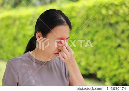 Stressed young Asian woman pinching nose bridge with red highlighted area indicating severe sinus pain, eye strain, allergy or migraine headache. Healthcare, sickness and medical concept outdoors. Stressed young Asian woman pinching nose bridge with red highlighted area indicating severe sinus pain, eye strain, allergy or migraine headache. Healthcare, sickness and medical concept outdoors. 143030474