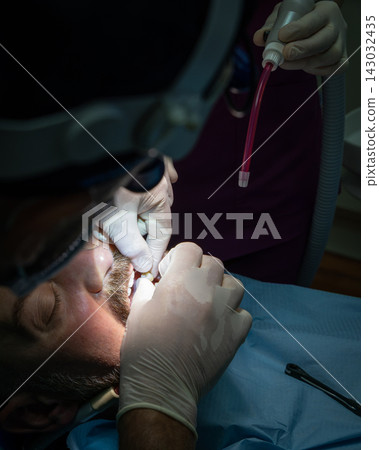 Dental team fitting implant restoration with suction during patient care Dental team fitting implant restoration with suction during patient care 143032435