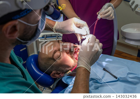 Dental team fitting an implant-supported tooth restoration with suction Dental team fitting an implant-supported tooth restoration with suction 143032436