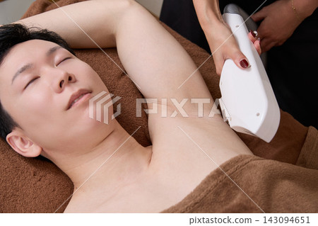 A man receiving underarm hair removal treatment. A man receiving underarm hair removal treatment. 143094651