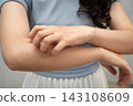 Asian woman itching of skin diseases using hand scratching. 143108609