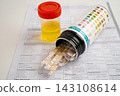 Urinalysis, urine cup with reagent strip pH paper test and comparison chart in laboratory. 143108614