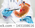 Stomach disease, doctor holding anatomy model for study diagnosis and treatment in hospital. 143108616