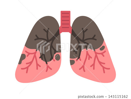 Lung Disease Anatomy Diagram Medical Cartoon Lung Disease Anatomy Diagram Medical Cartoon 143115162