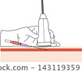 Ultrasound-guided vascular puncture ② Long-axis view Medical illustration of the procedure of advancing the needle at a horizontal position 143119359