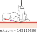 Ultrasound-guided vascular puncture ③ Long-axis view: Medical illustration of the procedure of advancing only the outer sheath. 143119360