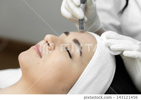 Closeup of female client undergoing microneedling procedure performed by cosmetologist in sterile environment. Advanced skincare therapy aims to boost collagen production and enhance facial glow Closeup of female client undergoing microneedling procedure performed by cosmetologist in sterile environment. Advanced skincare therapy aims to boost collagen production and enhance facial glow 143121456