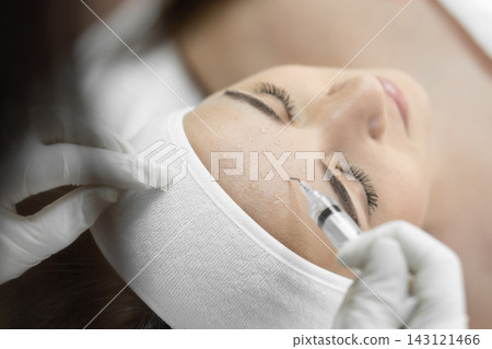Close up of a cosmetologist performing a mesotherapy injection on a woman's forehead during a skincare session. The scene highlights advanced beauty treatments and wellness trends in skincare Close up of a cosmetologist performing a mesotherapy injection on a woman's forehead during a skincare session. The scene highlights advanced beauty treatments and wellness trends in skincare 143121466