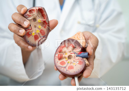 Chronic kidney disease, doctor with model for treatment urinary system, urology, Estimated glomerular filtration rate eGFR. Chronic kidney disease, doctor with model for treatment urinary system, urology, Estimated glomerular filtration rate eGFR. 143135712