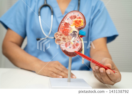 Chronic kidney disease, doctor with model for treatment urinary system, urology, Estimated glomerular filtration rate eGFR. Chronic kidney disease, doctor with model for treatment urinary system, urology, Estimated glomerular filtration rate eGFR. 143138792