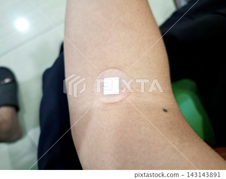 Adhesive medical patch applied on human arm skin for drug delivery or wound healing. Adhesive medical patch applied on human arm skin for drug delivery or wound healing. 143143891