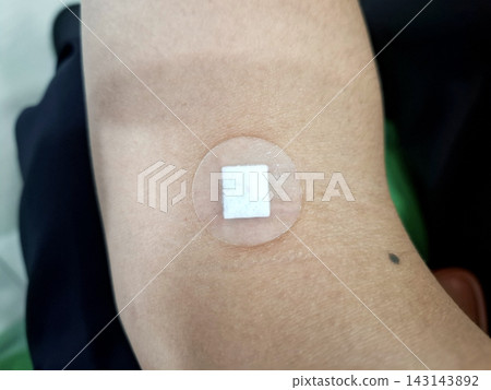 Adhesive medical patch applied on human arm skin Adhesive medical patch applied on human arm skin 143143892