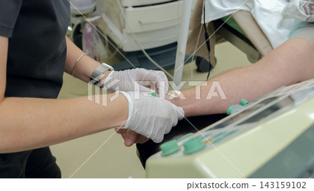 Nurse wearing protective gloves inserts intravenous cannula into patient forearm beside infusion chair, with medical tubing, adhesive tape, armrest, and clinical equipment visible during treatment 143159102