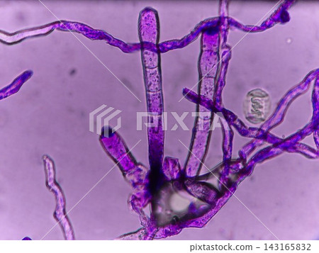 Powdery mildew conidia Powdery mildew conidia 143165832