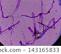 Microscopic images of plant disease fungi 143165833