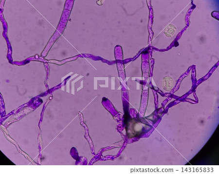 Microscopic images of plant disease fungi Microscopic images of plant disease fungi 143165833