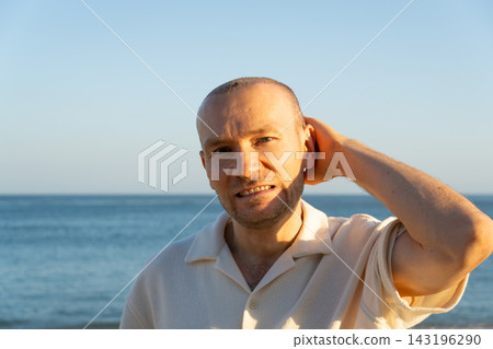 Man after hair transplant touching healing head on a beach in Portugal Man after hair transplant touching healing head on a beach in Portugal 143196290