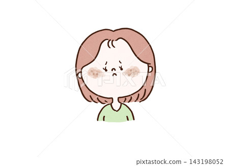 一位女性雙頰患有黃褐斑(一種皮膚瑕疵)。 一位女性雙頰患有黃褐斑(一種皮膚瑕疵)。 143198052