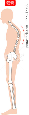 Poor posture (hunchback): Full body side view, spine and pelvis 143216599
