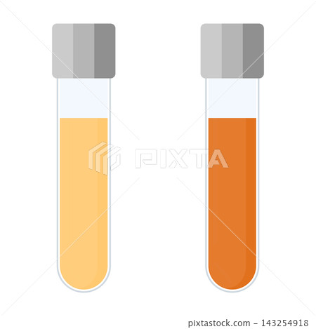 Urine sample tube set for urinary tract infection and cystitis. Ketone and PH rapid test for ketogenic and alkaline diets. Urine sample tube set for urinary tract infection and cystitis. Ketone and PH rapid test for ketogenic and alkaline diets. 143254918