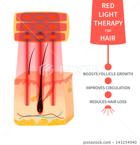 Red Follicle Depth Chart Vector Illustration Red Follicle Depth Chart Vector Illustration 143254940