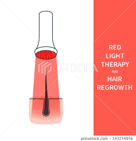 Red Hair Regrowth Panel Vector Illustration Red Hair Regrowth Panel Vector Illustration 143254956