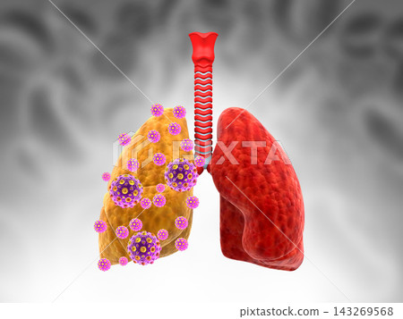 Human lungs with virus on medical background 143269568