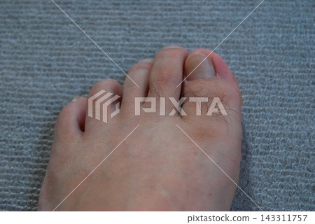 Close-up of toes and body hair Close-up of toes and body hair 143311757