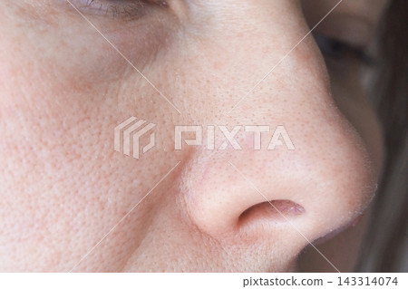 Human Nose Skin Showing Enlarged Pores And Facial Texture With Fine Vellus Hair And Dry Areas Human Nose Skin Showing Enlarged Pores And Facial Texture With Fine Vellus Hair And Dry Areas 143314074