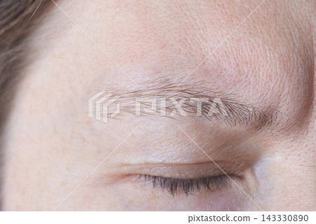Closed Eye With Relaxed Eyelid And Visible Brow Hairs In Close Up Skin Study Showing Fine Lines 143330890