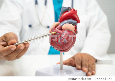 Cardiovascular disease CVD, doctor with heart human model. 143361968
