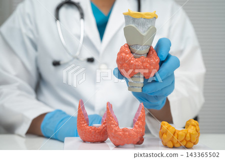 Hyperthyroidism, Overactive Thyroid, Thyroid Lymphoma, Asian doctor with thyroid gland human anatomy model in hospital. Hyperthyroidism, Overactive Thyroid, Thyroid Lymphoma, Asian doctor with thyroid gland human anatomy model in hospital. 143365502
