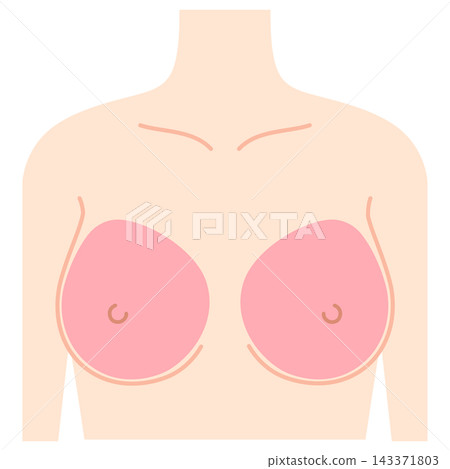 Breast augmentation, breast design, hyaluronic acid injection sites 143371803