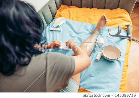 Woman changing a bandage on her injured leg while recovering at home. Medical supplies, crutch, and home care equipment are visible, illustrating first aid, rehabilitation, wound treatment, and Woman changing a bandage on her injured leg while recovering at home. Medical supplies, crutch, and home care equipment are visible, illustrating first aid, rehabilitation, wound treatment, and 143389739