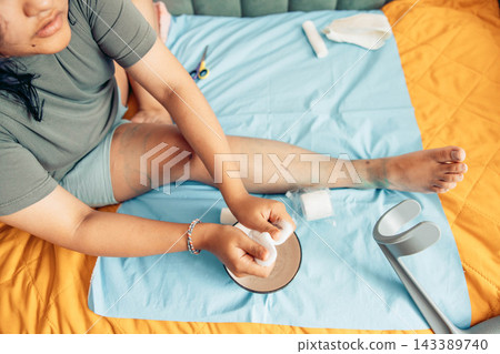 plus size young woman performing home wound care for a bruised and injured leg while sitting on a bed with gauze pads, bandages, and a crutch nearby, illustrating recovery, first aid, and 143389740