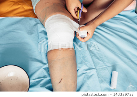 person cutting medical bandage from leg after surgery, home wound care on bed with blue sheet, yellow blanket, recovery process, healthcare, medical service, rehabilitation, top view person cutting medical bandage from leg after surgery, home wound care on bed with blue sheet, yellow blanket, recovery process, healthcare, medical service, rehabilitation, top view 143389752