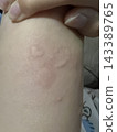 Allergies ☆mar_lapin 143389765