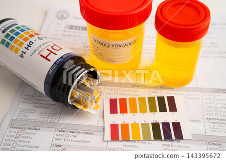 Urinalysis, urine cup with reagent strip pH paper test and comparison chart in laboratory. 143395672