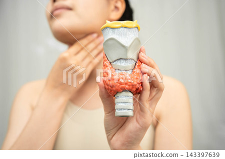 Hyperthyroidism, Overactive Thyroid, Thyroid Lymphoma, Asian woman with thyroid gland human anatomy model. Hyperthyroidism, Overactive Thyroid, Thyroid Lymphoma, Asian woman with thyroid gland human anatomy model. 143397639