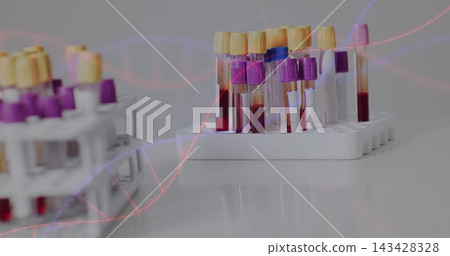 Displaying white rack holding blood tubes with colored caps on glossy benchtop, DNA overlay Displaying white rack holding blood tubes with colored caps on glossy benchtop, DNA overlay 143428328