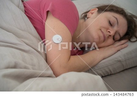 A woman is sleeping with a continuous glucose monitoring sensor on her arm. A woman is sleeping with a continuous glucose monitoring sensor on her arm. 143484763