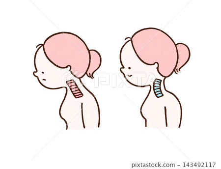 正常頸椎與頸部筆直的女性的比較圖。 143492117