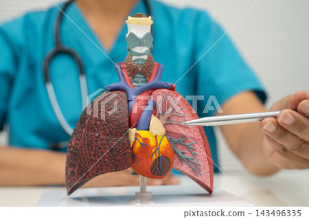 Pneumonia, lung cancer, Asian doctor with human lung model. Pneumonia, lung cancer, Asian doctor with human lung model. 143496335