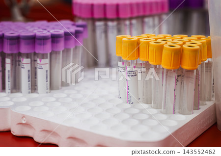 Vacutainer Blood Tubes in a Laboratory Rack. Rows of vacutainer blood collection tubes with purple and orange caps stand in a rack at a clinic, donor blood samples ready for testing. 143552462