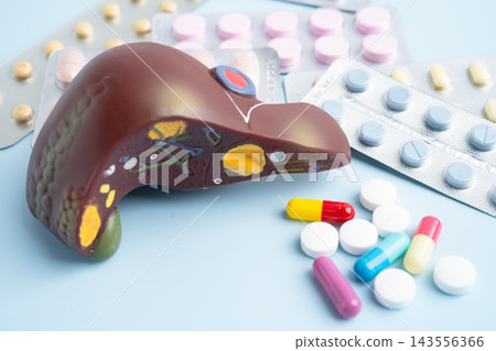 Liver model with pill drug treatment, Cirrhosis, Liver cancer, fatty liver. 143556366