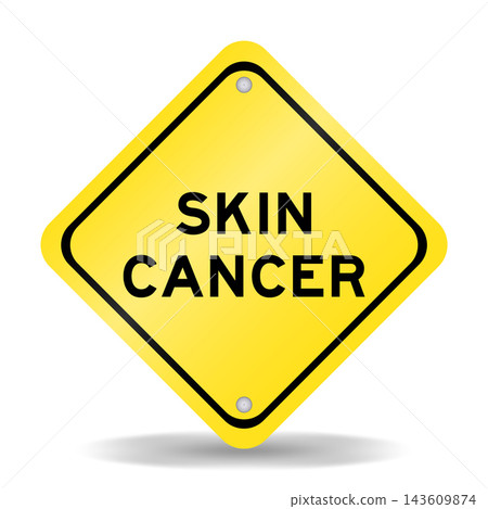 Yellow color transportation sign with word skin cancer on white background Yellow color transportation sign with word skin cancer on white background 143609874