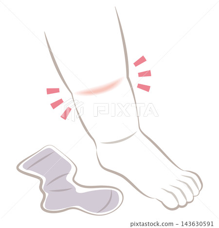 腿部腫脹 143630591