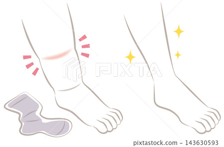 腿部腫脹：前後對比 143630593