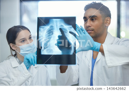 Hospital, teamwork and doctors with x ray for surgery, operation and medical procedure in clinic. Healthcare, collaboration and man with woman for chest scan as diagnosis, review or medicare service 143642662