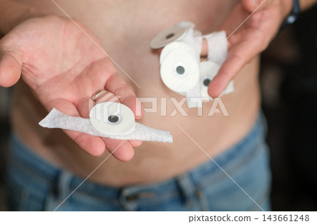 Individual displays Holter monitor electrodes and adhesive pads in hands, emphasizing personal health monitoring equipment in a medical setting Individual displays Holter monitor electrodes and adhesive pads in hands, emphasizing personal health monitoring equipment in a medical setting 143661248